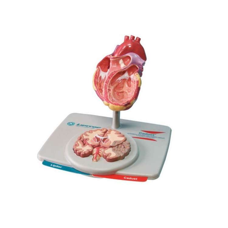 Модель сердца и мозга